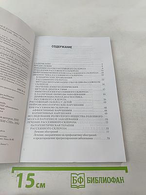 Рассеянный склероз