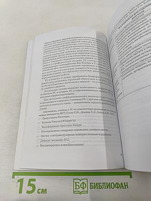 Рассеянный склероз