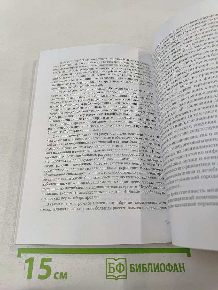 Рассеянный склероз