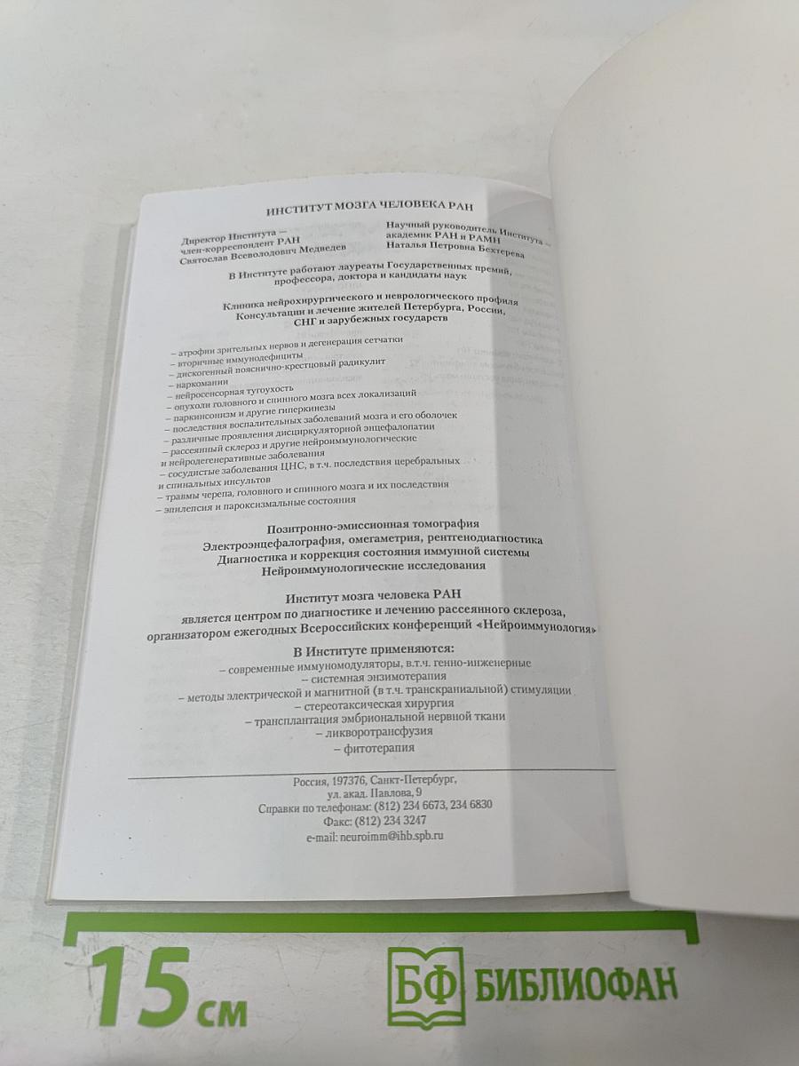 Рассеянный склероз