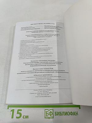 Рассеянный склероз