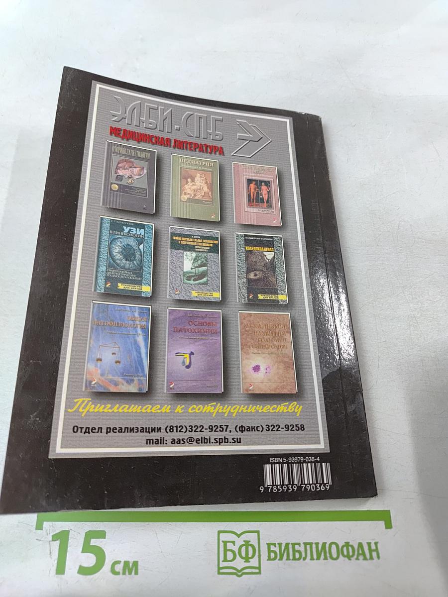 Рассеянный склероз