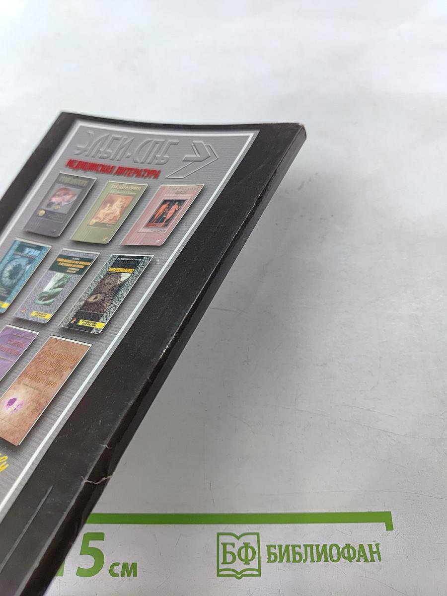 Рассеянный склероз