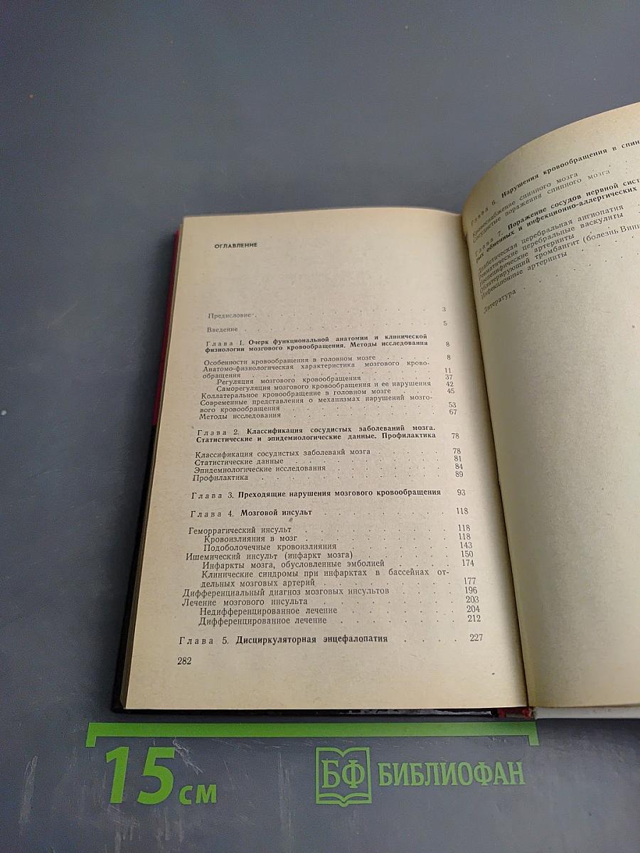 Сосудистые заболевания головного и спинного мозга