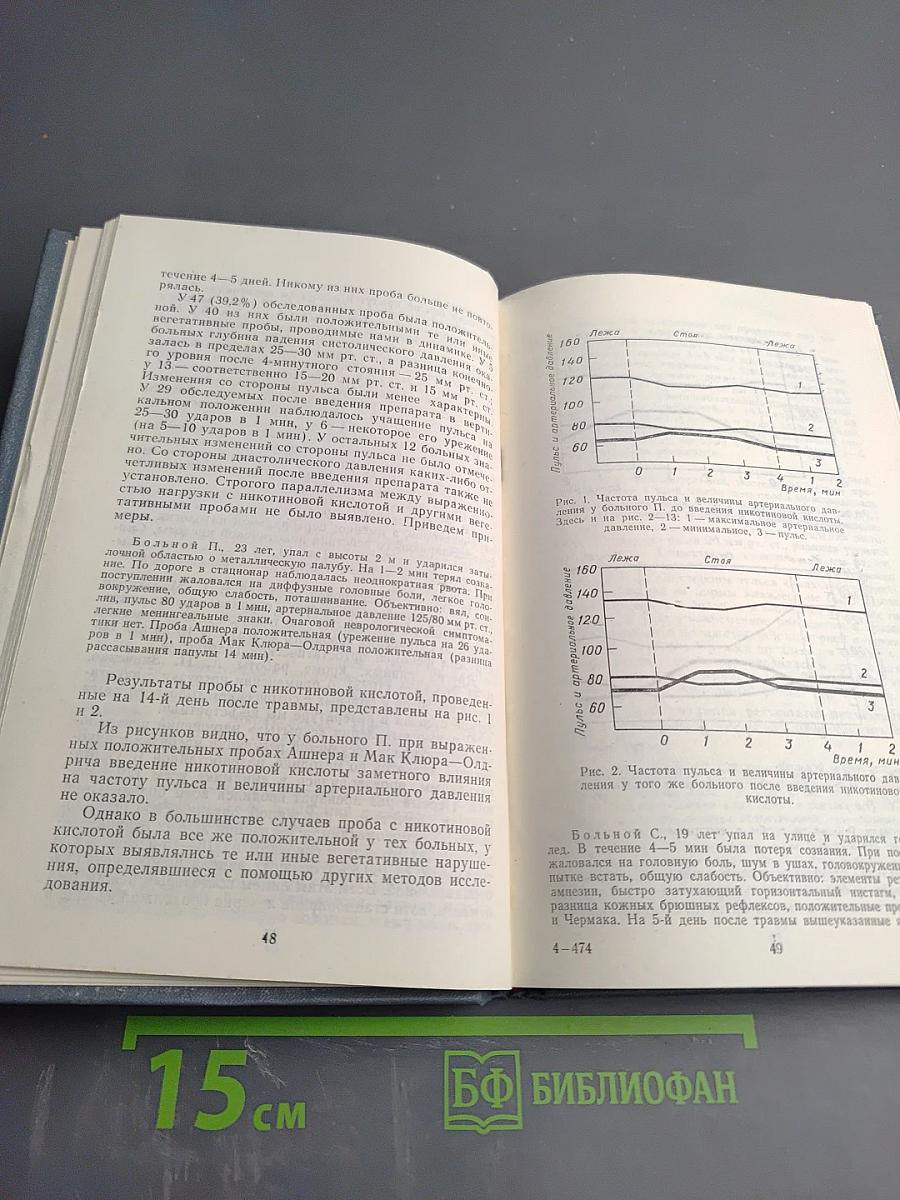 Сотрясение головного мозга легкой степени