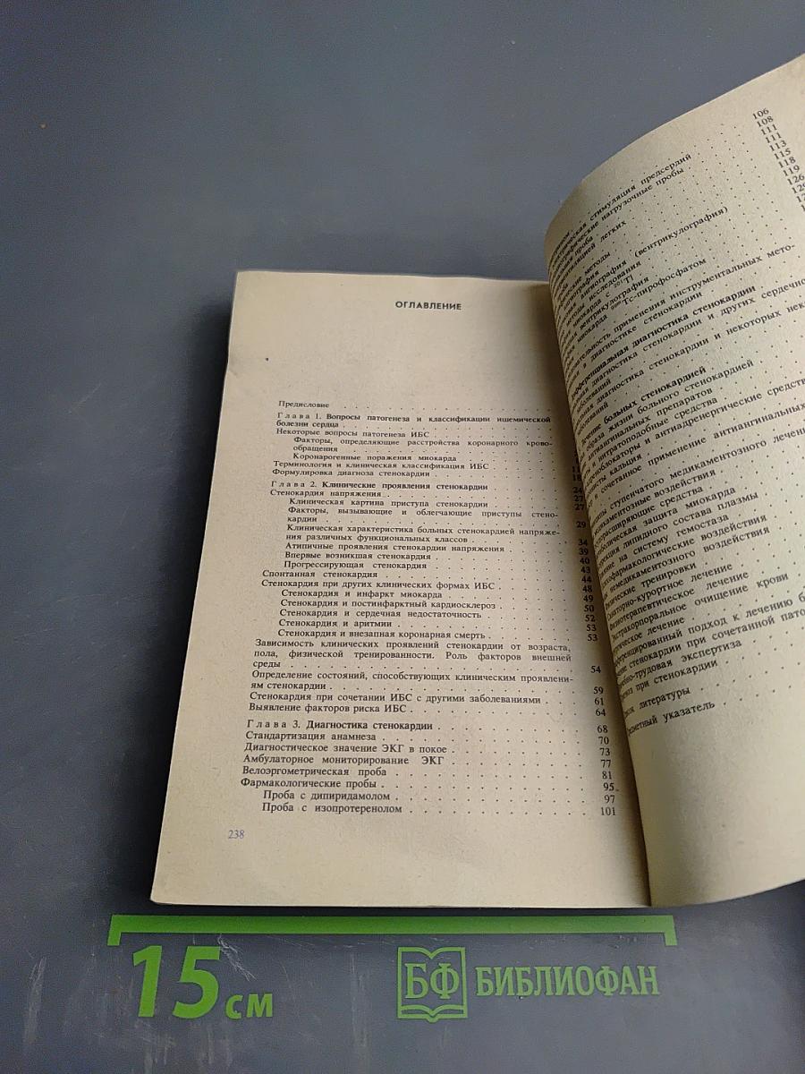 Стенокардия