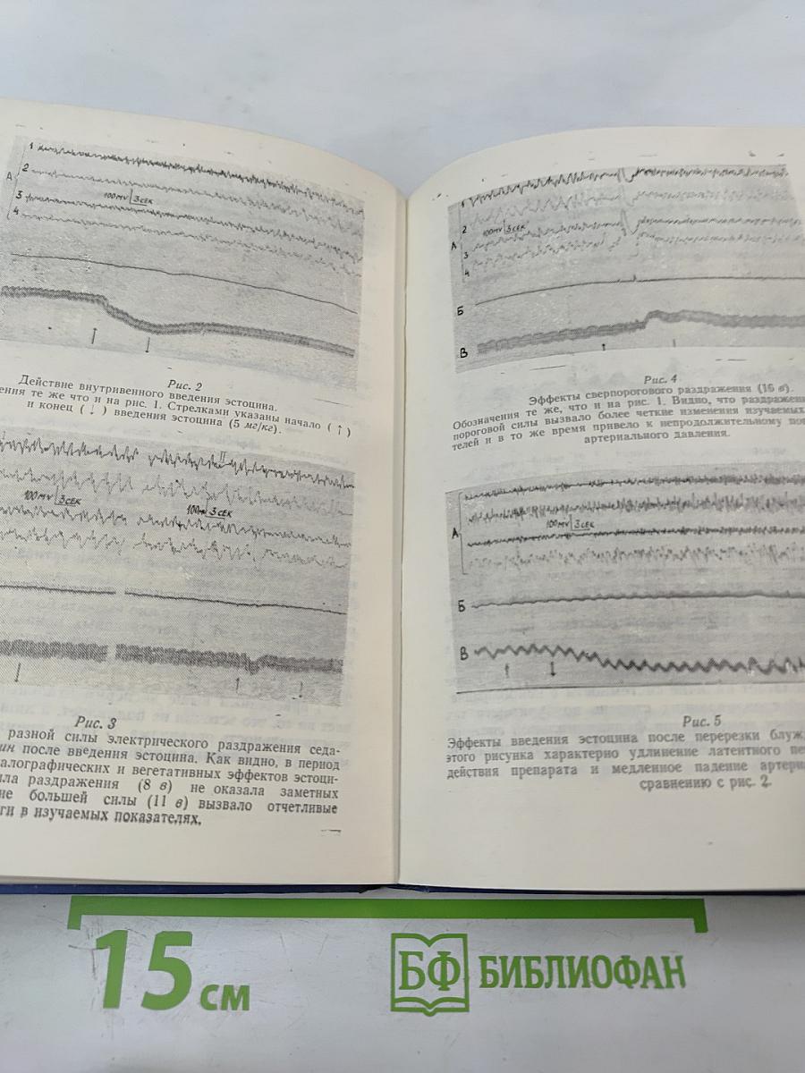 Вопросы нейрофизиологии и нейрофармакологии