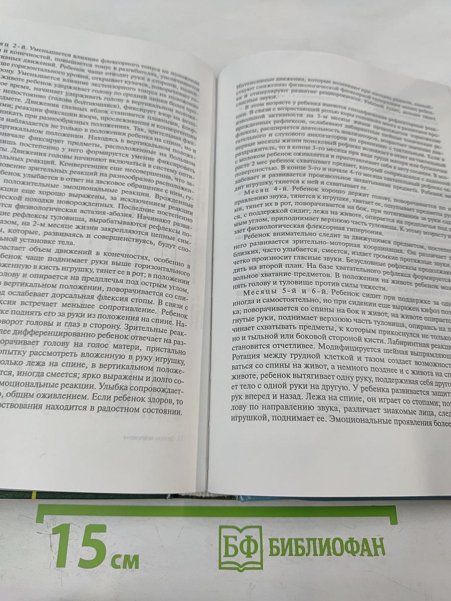 Детская неврология