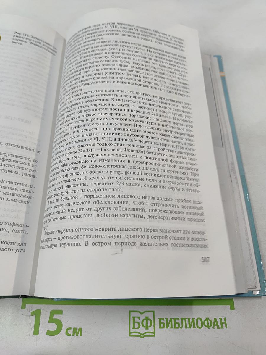 Детская неврология