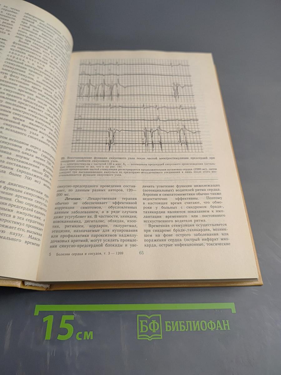 Болезни сердца и сосудов. Том 3