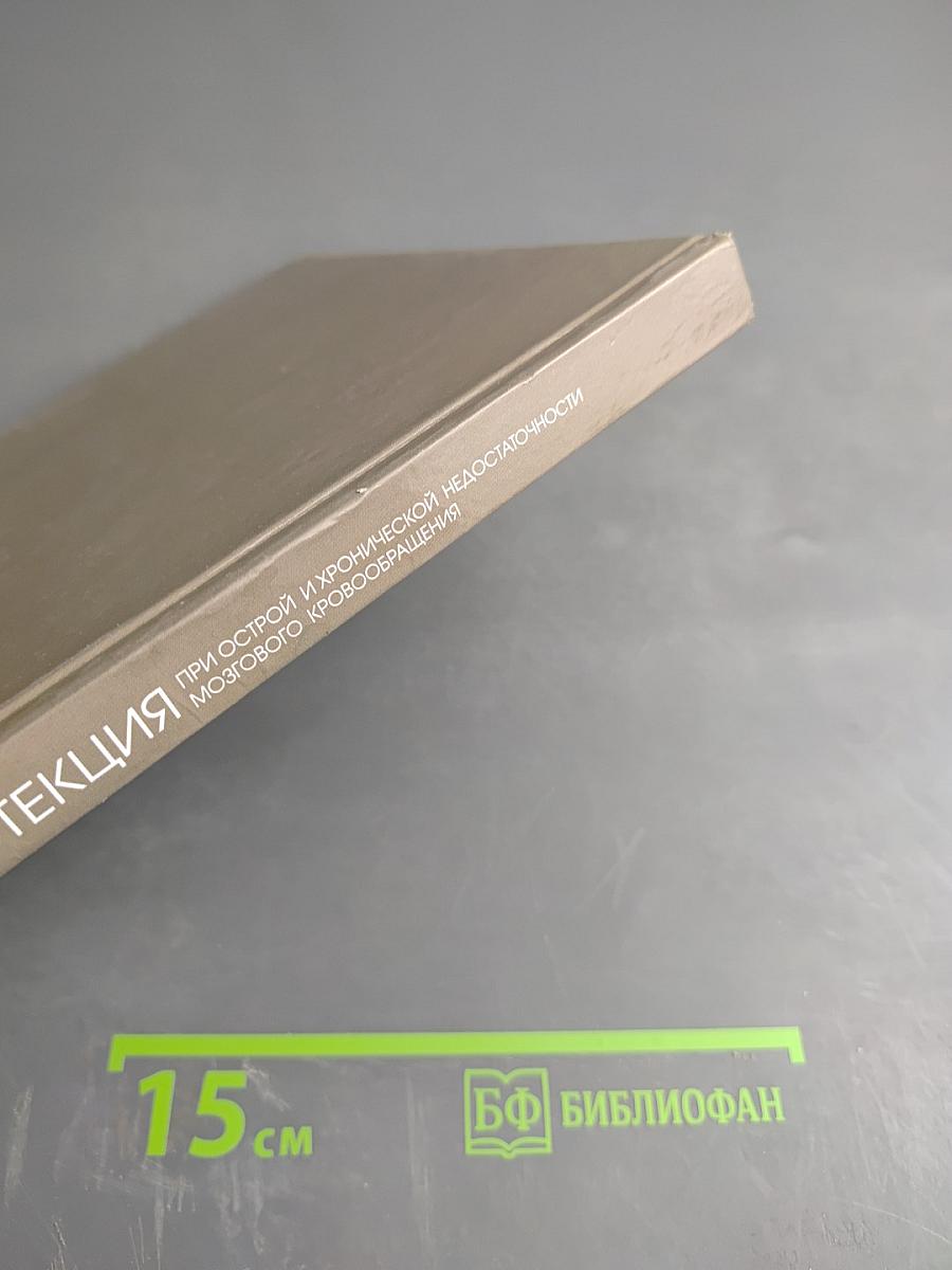 Нейропротекция при острой и хронической недостаточности мозгового кровообращения