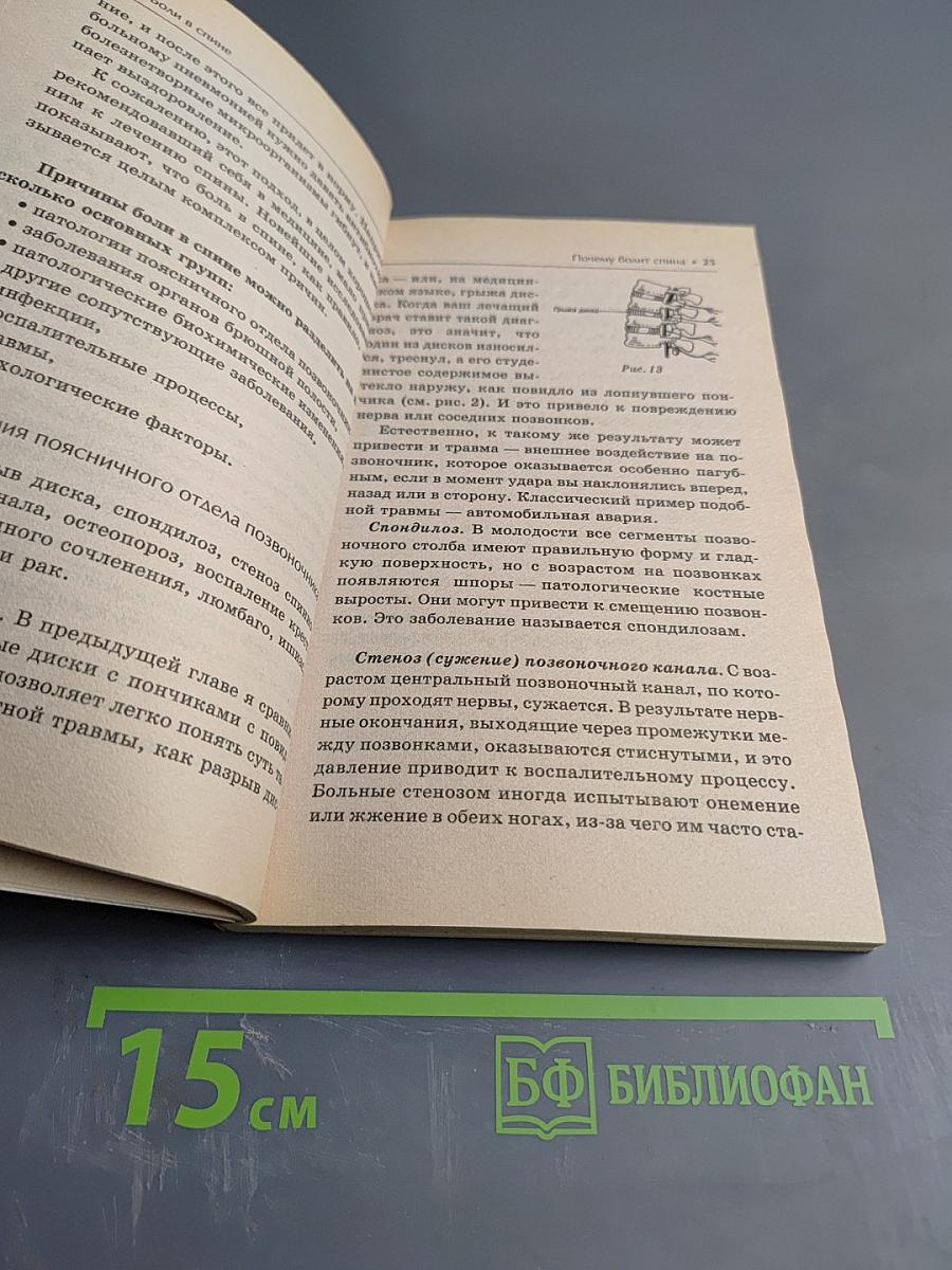 Боли в спине: Всё, что вы должны знать