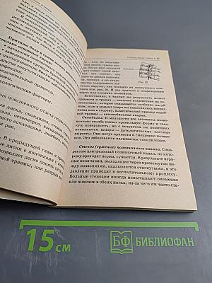 Боли в спине: Всё, что вы должны знать