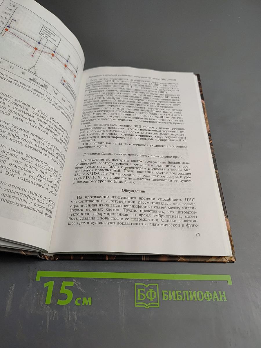 Терапевтический потенциал клеток пуповинной крови при негематологических заболеваниях