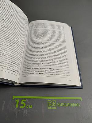 Рассеянный склероз. Справочник