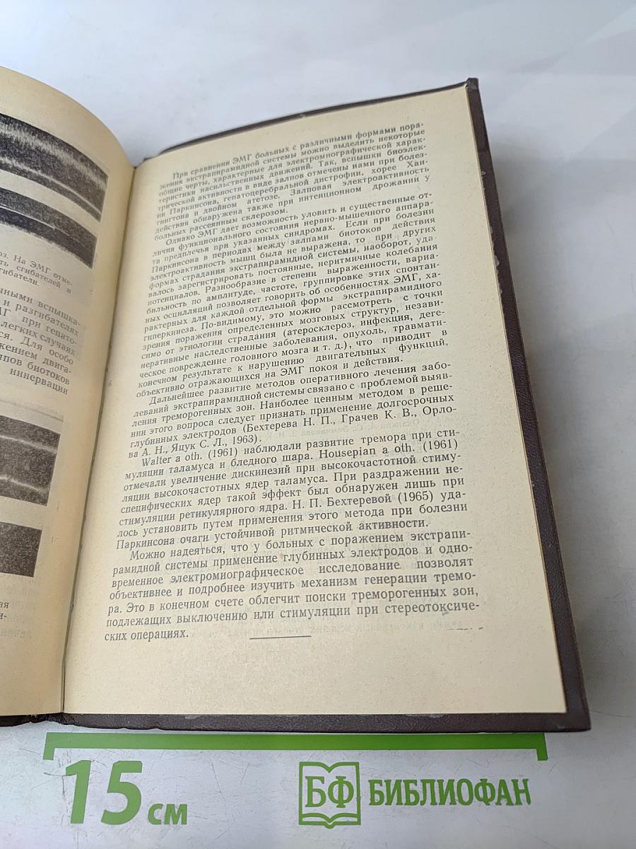 Электрофизиологические исследования нервной системы в норме и патологии