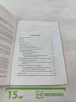 Ранний ревматоидный артрит: Принципы диагностики и лечения