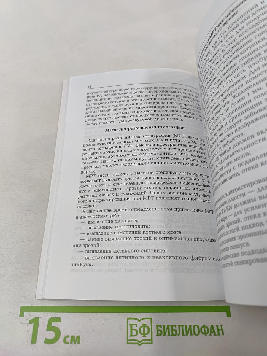 Ранний ревматоидный артрит: Принципы диагностики и лечения