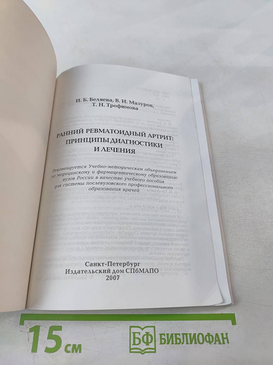 Ранний ревматоидный артрит: Принципы диагностики и лечения