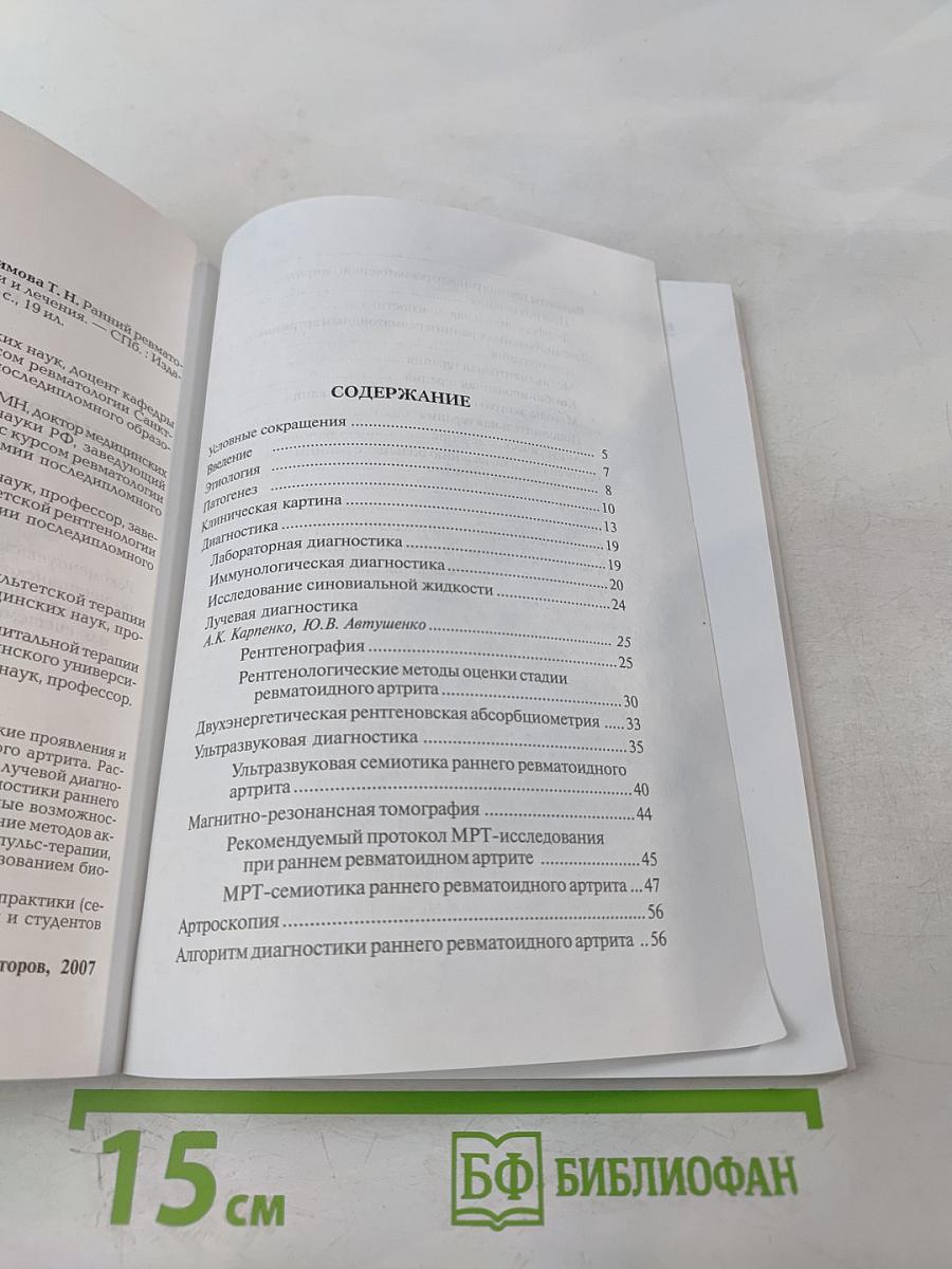 Ранний ревматоидный артрит: Принципы диагностики и лечения