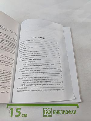 Ранний ревматоидный артрит: Принципы диагностики и лечения