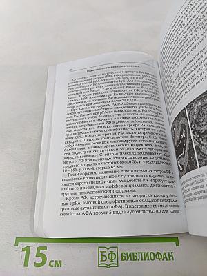 Ранний ревматоидный артрит: Принципы диагностики и лечения