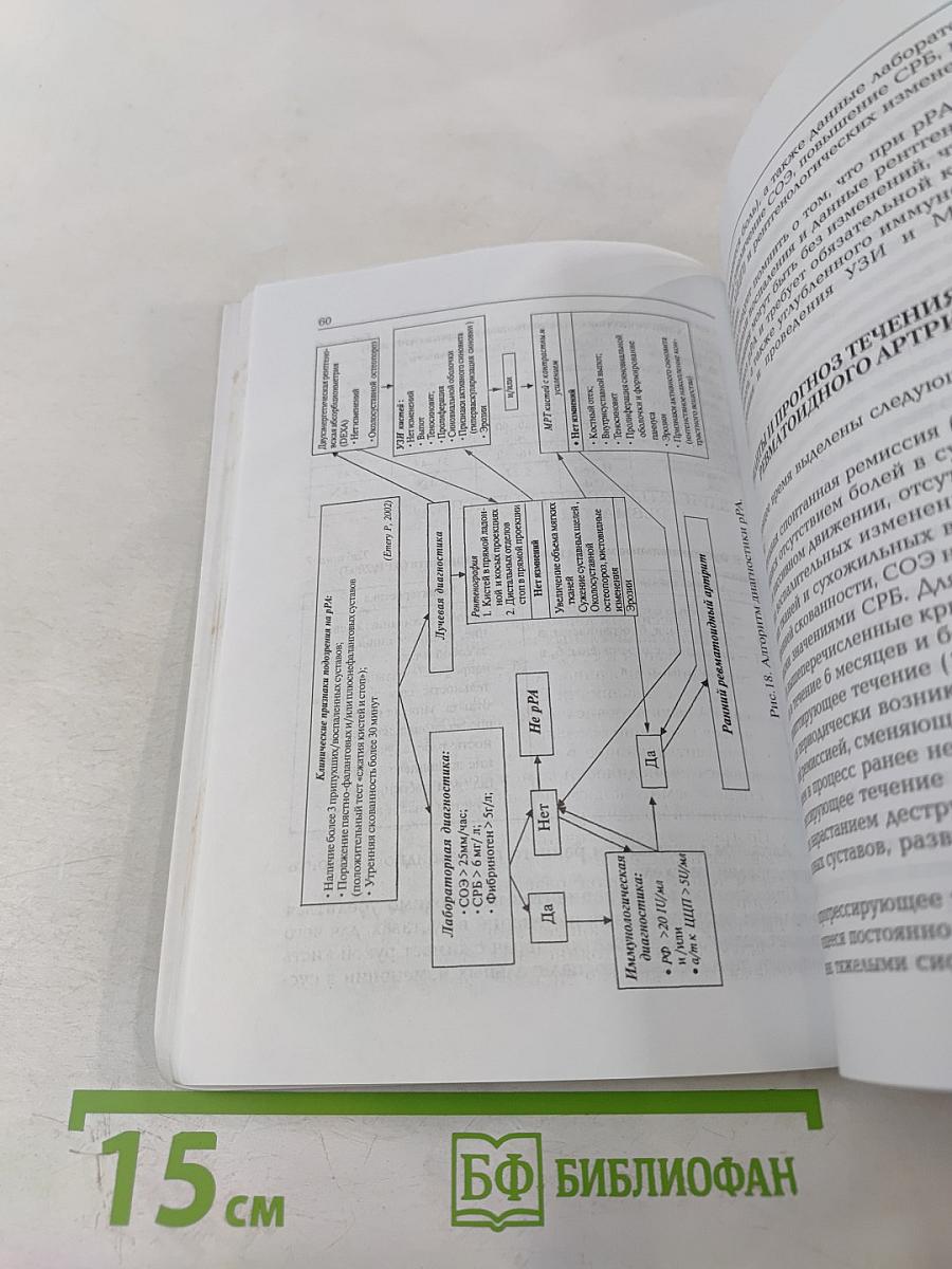Ранний ревматоидный артрит: Принципы диагностики и лечения