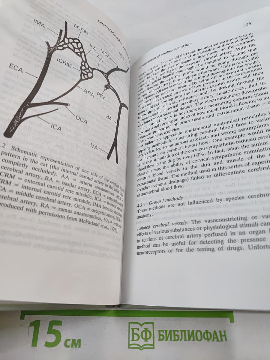 Cerebral blood flow and metabolism
