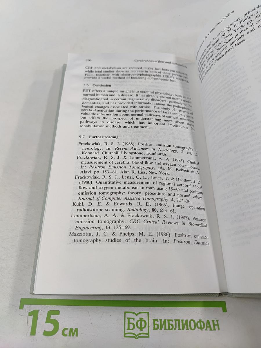 Cerebral blood flow and metabolism