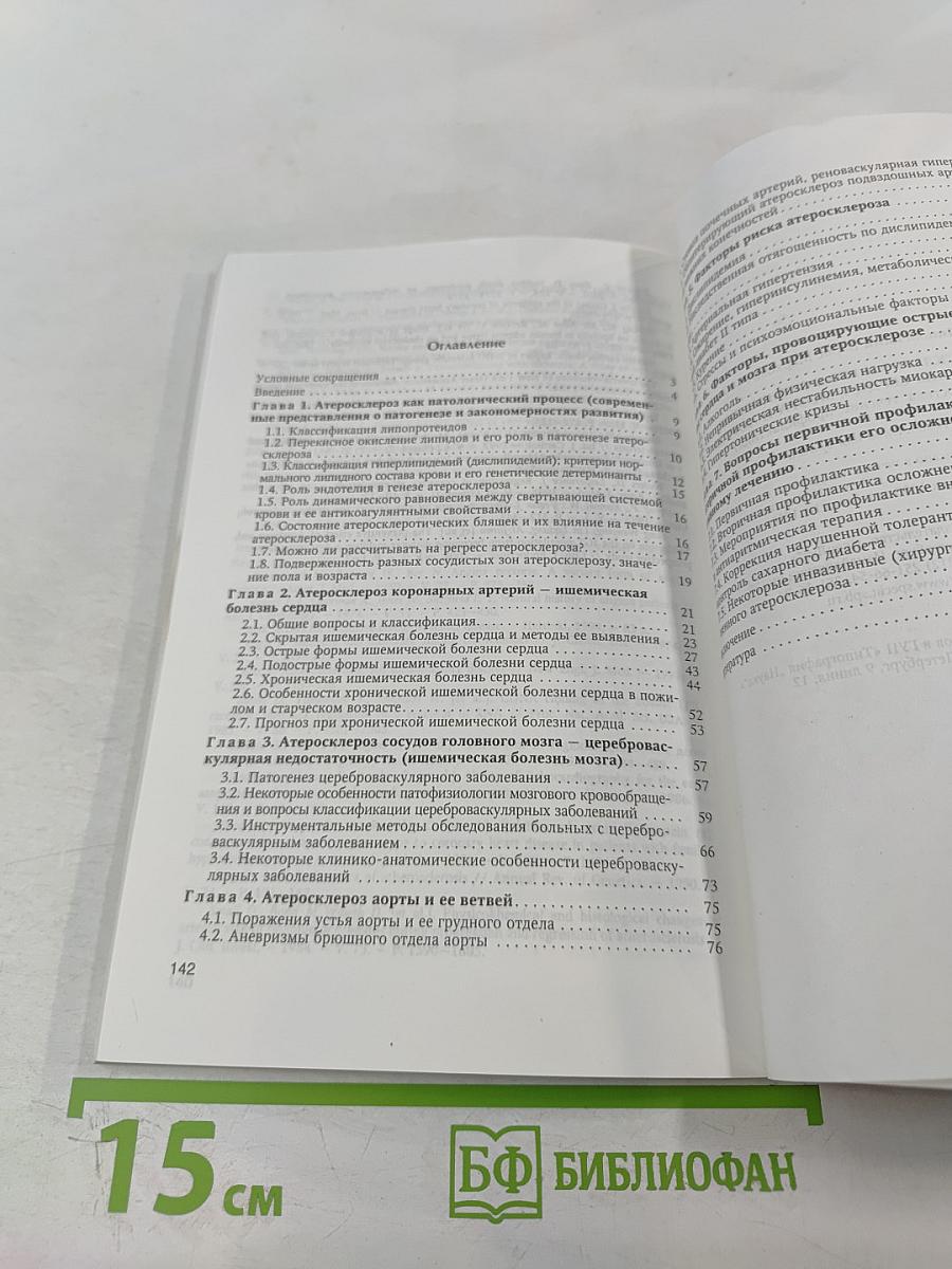 Атеросклероз и его осложнения со стороны сердца, мозга и аорты