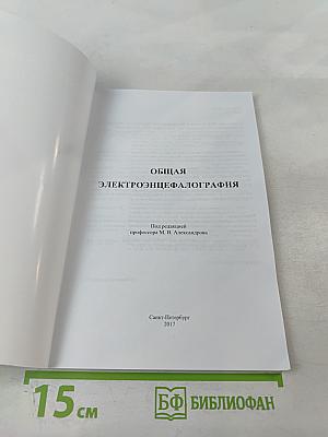 Общая Электроэнцефалография