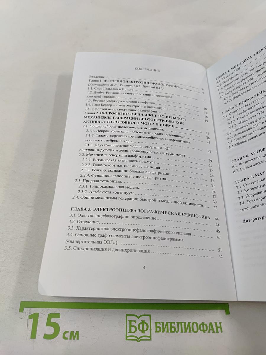 Общая Электроэнцефалография