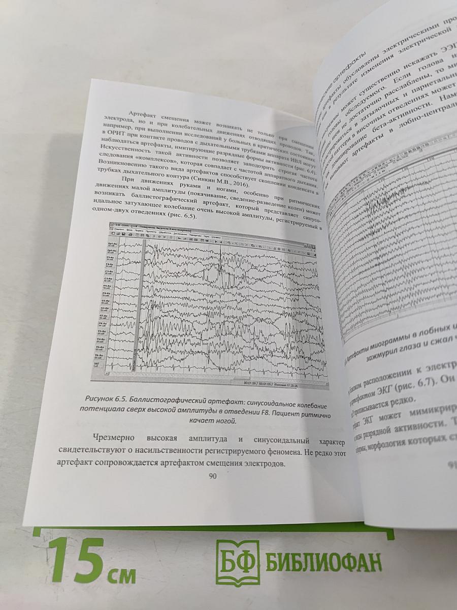 Общая Электроэнцефалография