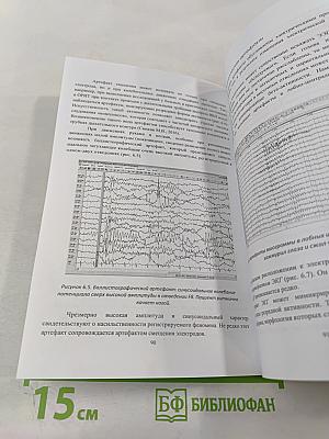 Общая Электроэнцефалография