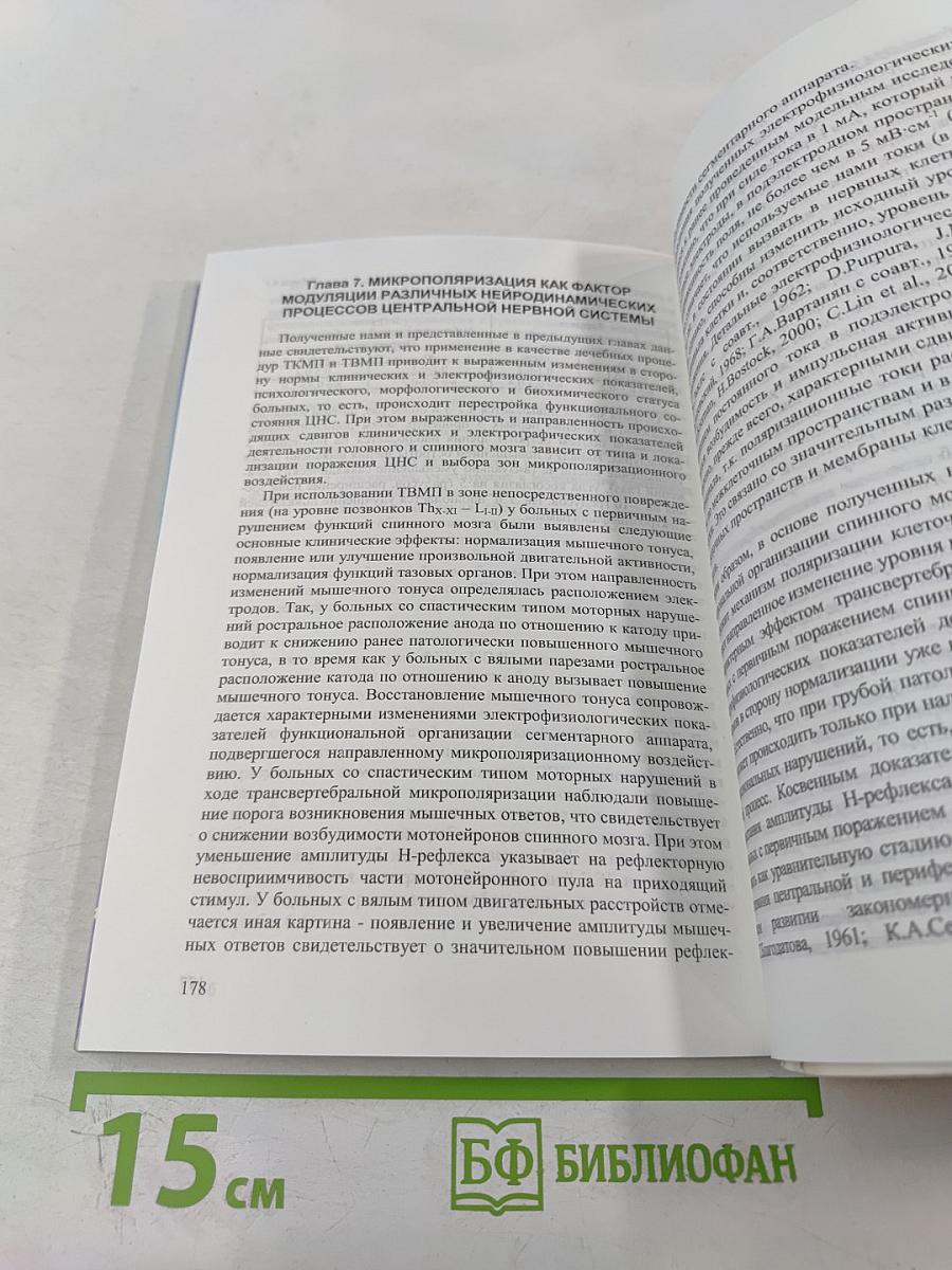 Микрополяризация мозга. Теоретические и практические аспекты