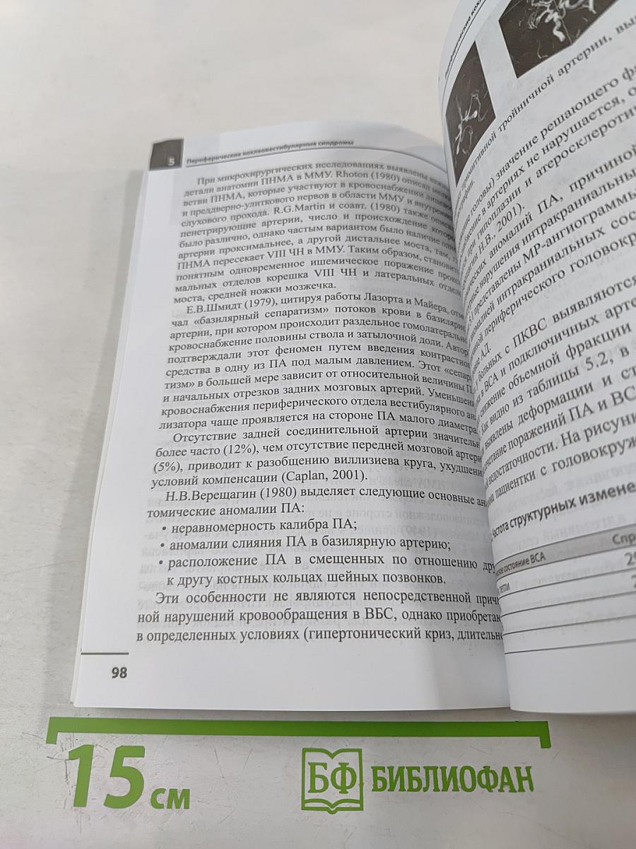 Головокружение. Отоневрологические аспекты