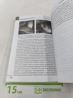 Головокружение. Отоневрологические аспекты