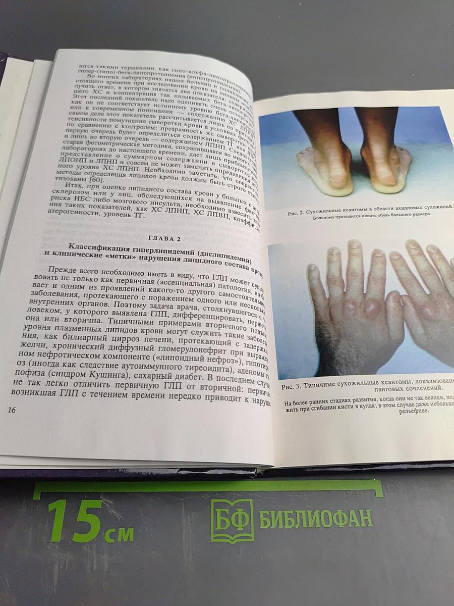 Клиническая липидология