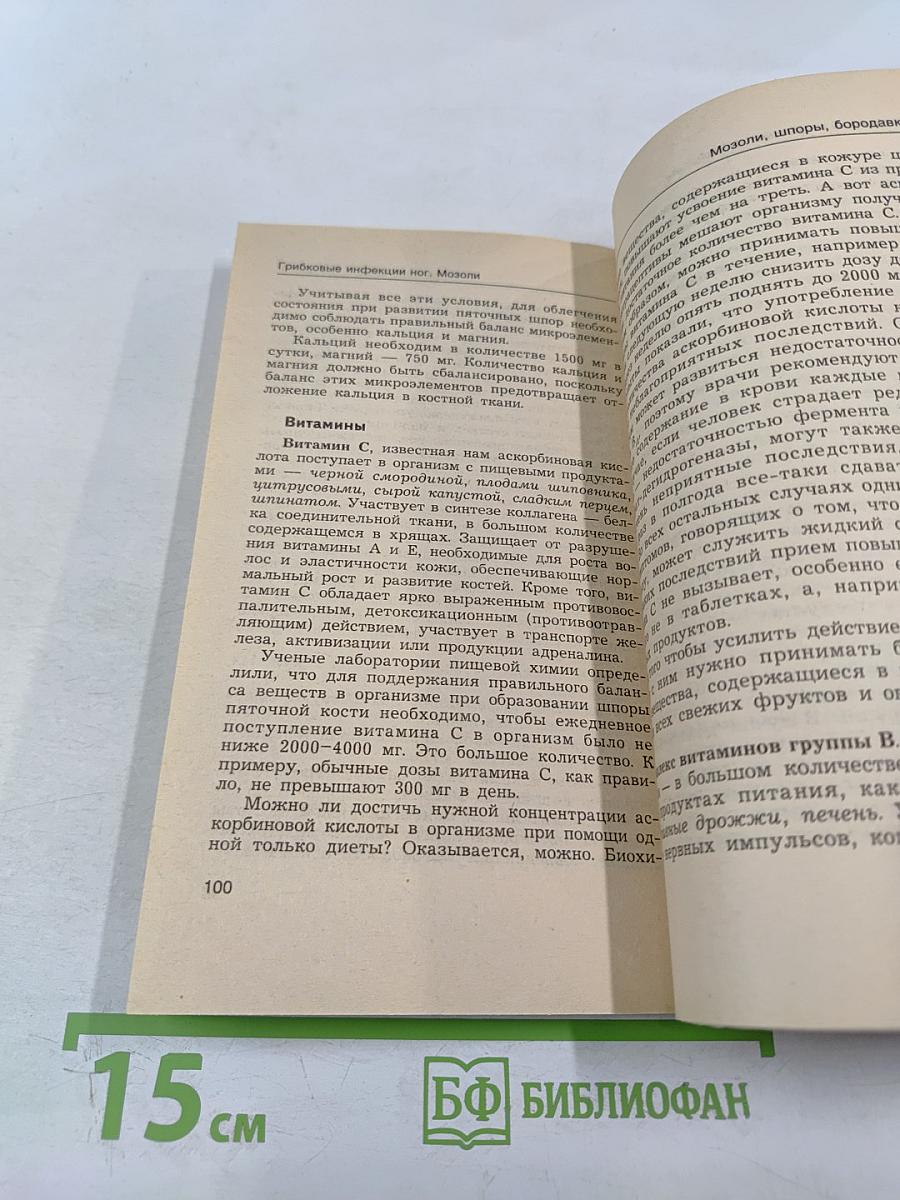 Грибковые инфекции ног. Мозоли