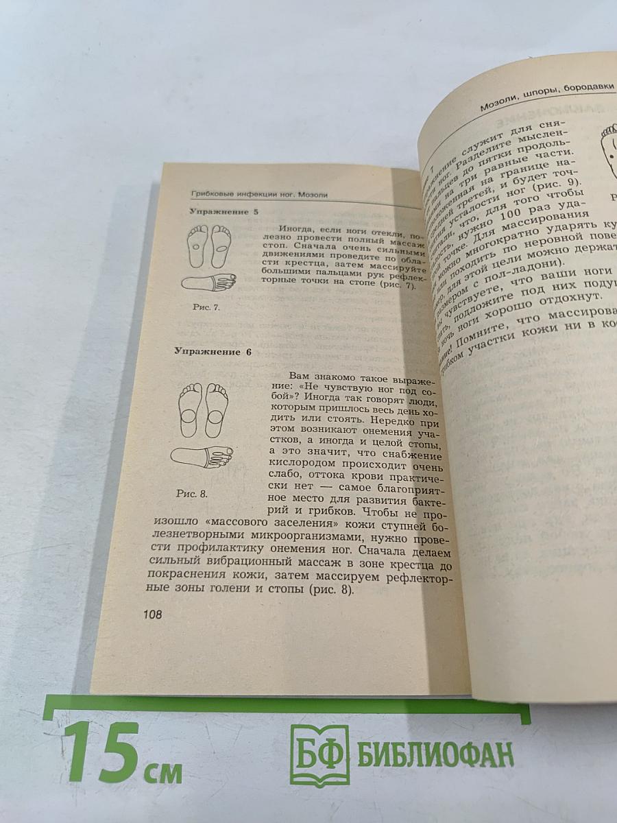 Грибковые инфекции ног. Мозоли