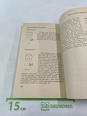 Грибковые инфекции ног. Мозоли