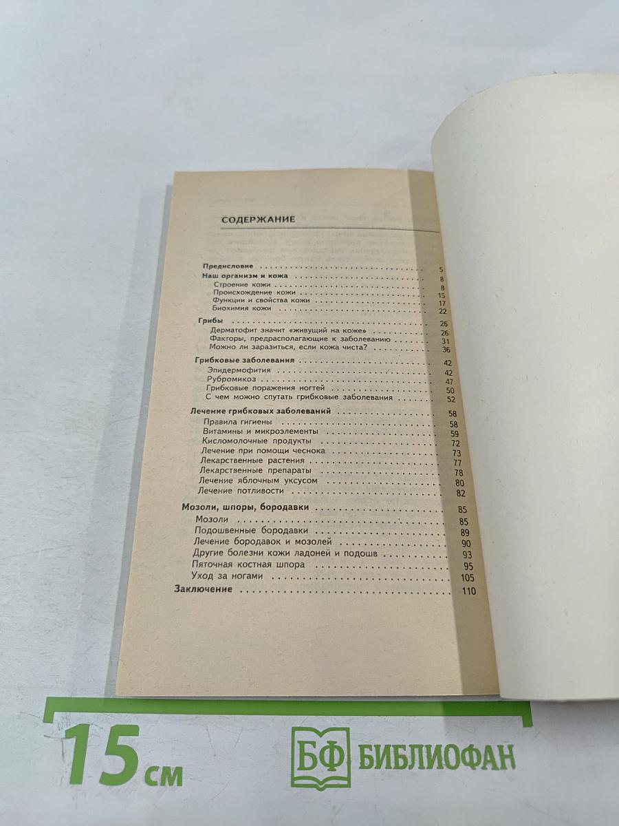 Грибковые инфекции ног. Мозоли