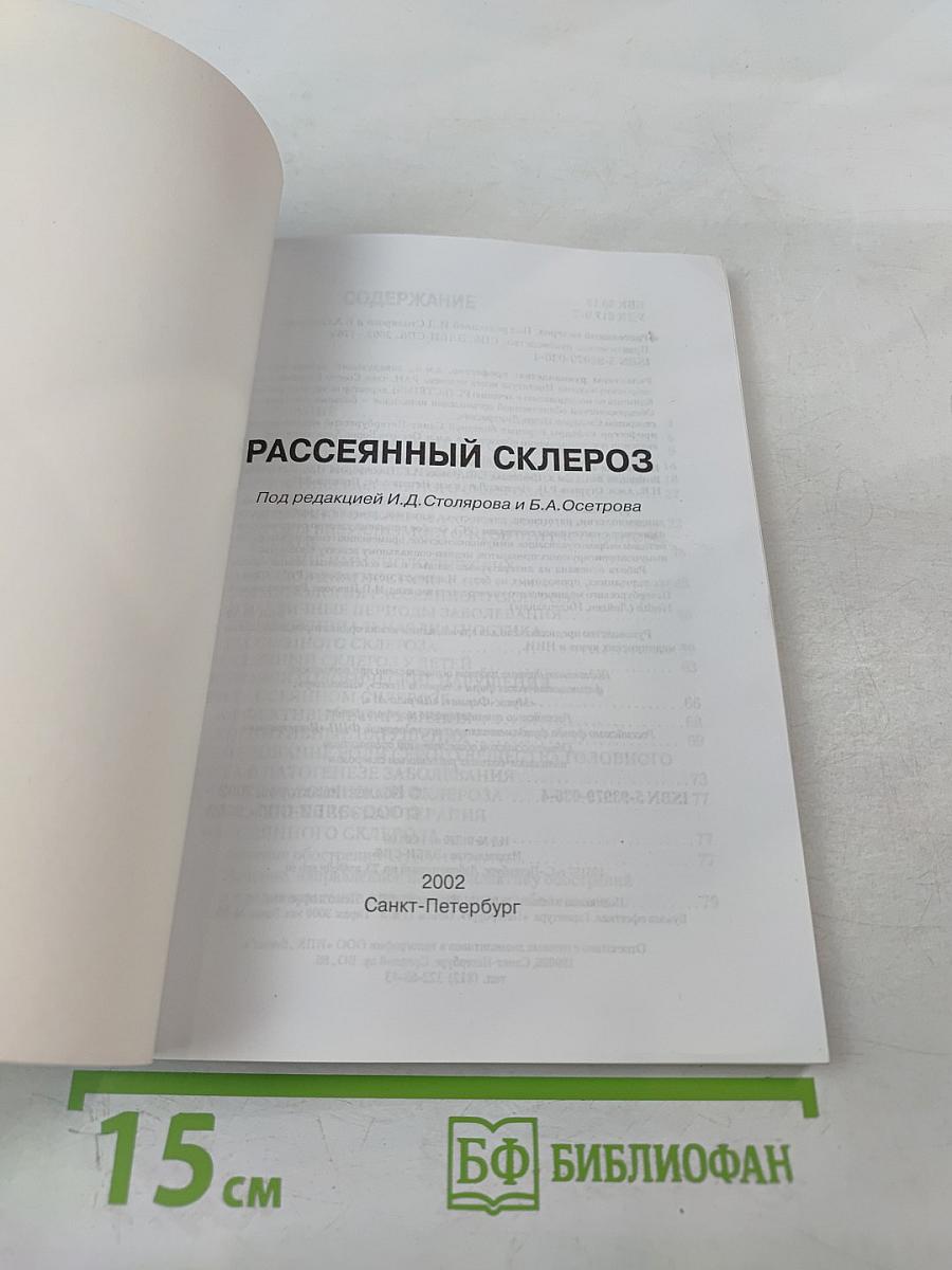 Рассеянный склероз
