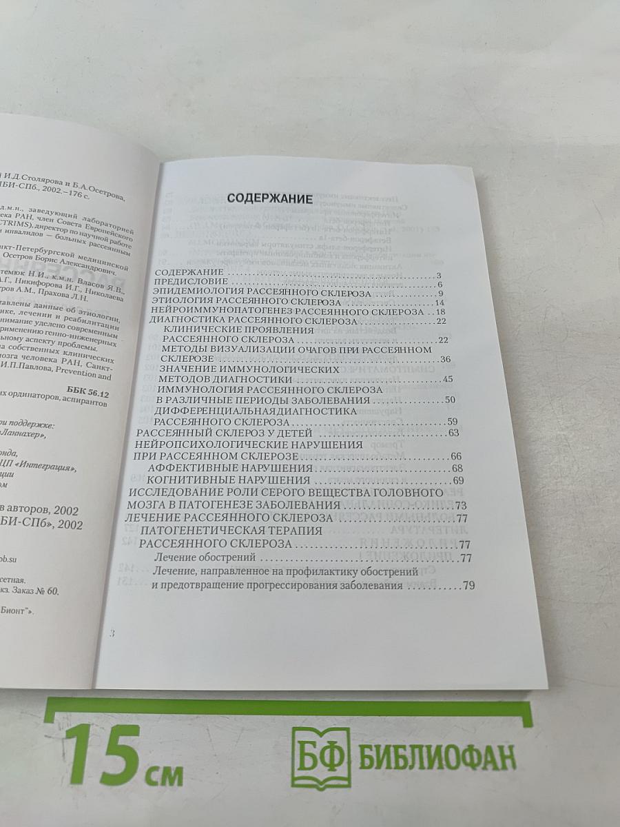 Рассеянный склероз