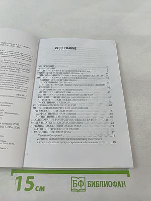 Рассеянный склероз