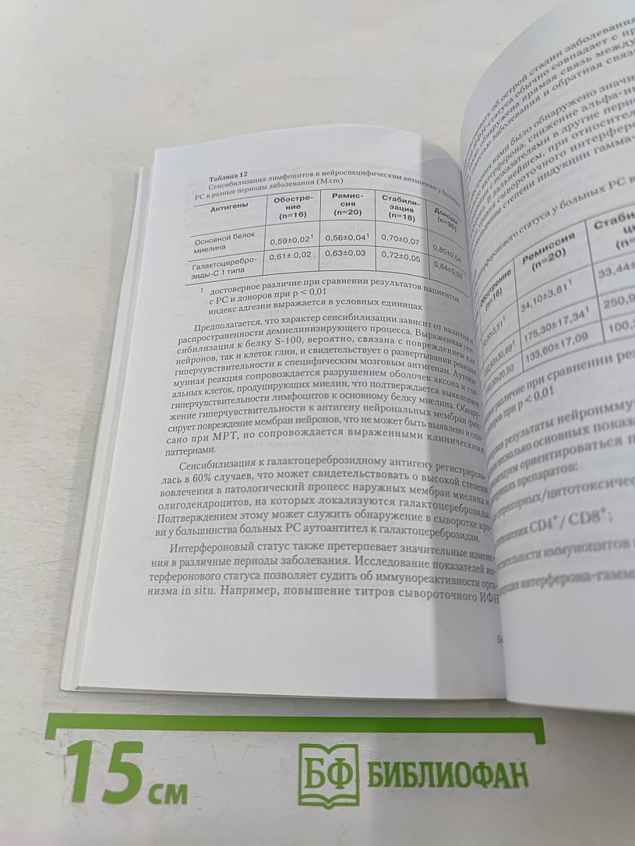 Рассеянный склероз