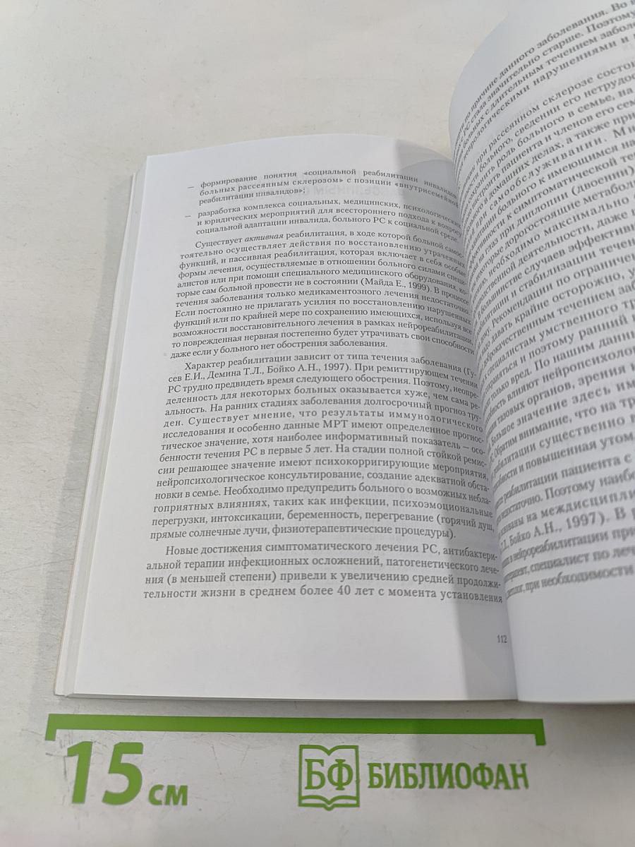 Рассеянный склероз