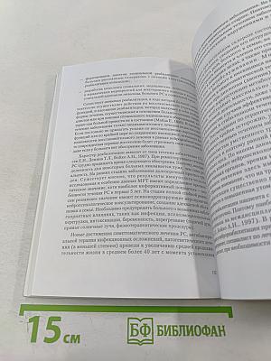 Рассеянный склероз