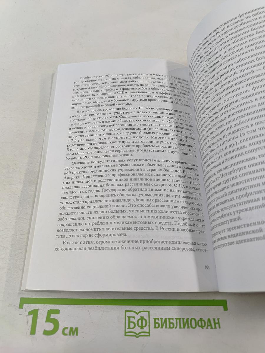 Рассеянный склероз