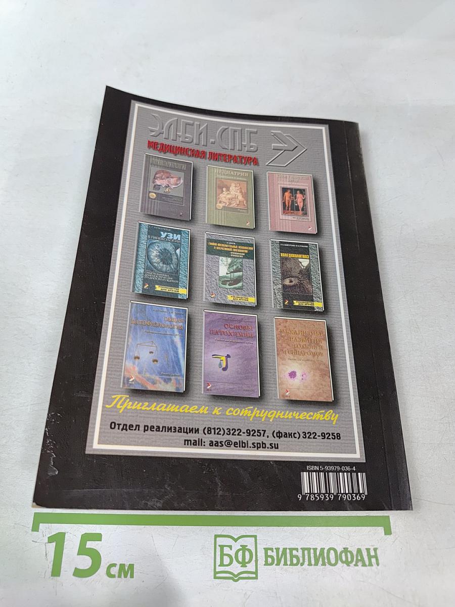 Рассеянный склероз